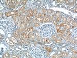 HPS6 Antibody in Immunohistochemistry (Paraffin) (IHC (P))