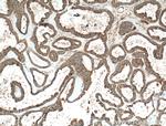 HPS6 Antibody in Immunohistochemistry (Paraffin) (IHC (P))