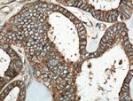 HPS6 Antibody in Immunohistochemistry (Paraffin) (IHC (P))