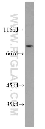 HPS6 Antibody in Western Blot (WB)