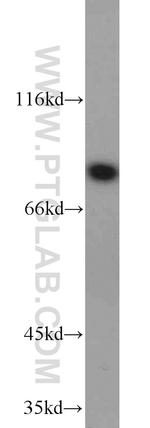 HPS6 Antibody in Western Blot (WB)