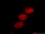 TLE3 Antibody in Immunocytochemistry (ICC/IF)