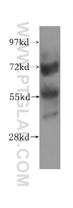 ZNF266 Antibody in Western Blot (WB)
