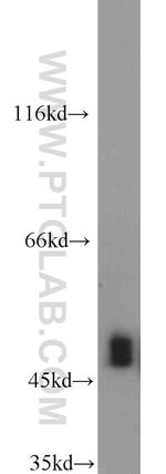 FH Antibody in Western Blot (WB)