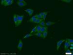 SULT1A4 Antibody in Immunocytochemistry (ICC/IF)