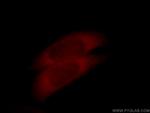 SULT1A4 Antibody in Immunocytochemistry (ICC/IF)
