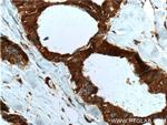 SULT1A4 Antibody in Immunohistochemistry (Paraffin) (IHC (P))