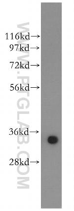 SULT1A4 Antibody in Western Blot (WB)