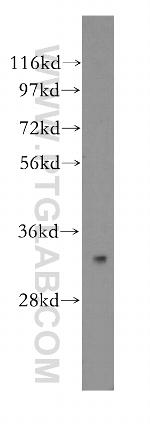 SULT1A4 Antibody in Western Blot (WB)