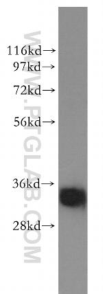 SULT1A4 Antibody in Western Blot (WB)