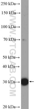 SULT1A4 Antibody in Western Blot (WB)