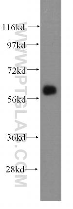 ARHGEF5 Antibody in Western Blot (WB)