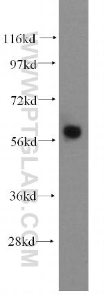 ARHGEF5 Antibody in Western Blot (WB)