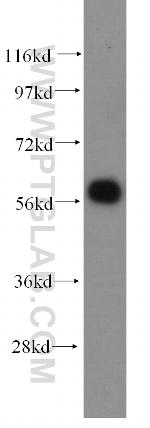 ARHGEF5 Antibody in Western Blot (WB)