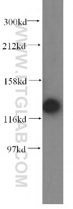 DDB1 Antibody in Western Blot (WB)