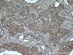 Cortactin Antibody in Immunohistochemistry (Paraffin) (IHC (P))