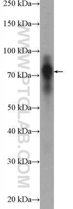 Cortactin Antibody in Western Blot (WB)