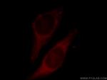 ECH1 Antibody in Immunocytochemistry (ICC/IF)