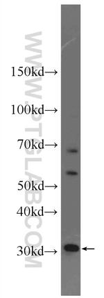 ECH1 Antibody in Western Blot (WB)