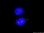 PWP2 Antibody in Immunocytochemistry (ICC/IF)