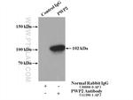 PWP2 Antibody in Immunoprecipitation (IP)