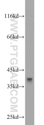 NT5C3 Antibody in Western Blot (WB)