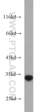 NT5C3 Antibody in Western Blot (WB)