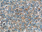 GKAP1 Antibody in Immunohistochemistry (Paraffin) (IHC (P))