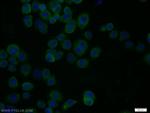 RPH3A Polyclonal Antibody