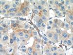 SEPT2 Antibody in Immunohistochemistry (Paraffin) (IHC (P))