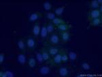 POF1B Antibody in Immunocytochemistry (ICC/IF)