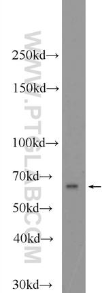 POF1B Antibody in Western Blot (WB)