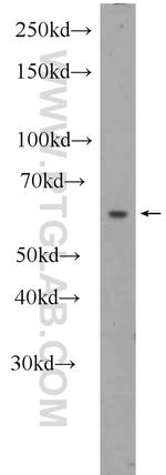 POF1B Antibody in Western Blot (WB)