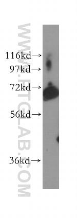 POF1B Antibody in Western Blot (WB)