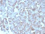 ADCY8 (Adenylate Cyclase 8) Monoclonal Antibody (ADCY8/7573)