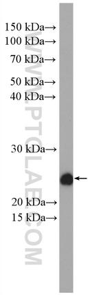 ASRGL1 Antibody in Western Blot (WB)