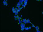 alpha Adaptin Antibody in Immunocytochemistry (ICC/IF)