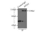 alpha Adaptin Antibody in Immunoprecipitation (IP)