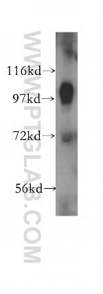 alpha Adaptin Antibody in Western Blot (WB)