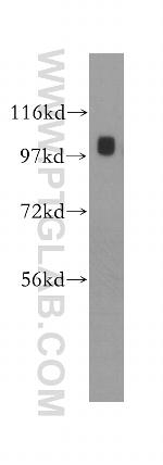 alpha Adaptin Antibody in Western Blot (WB)