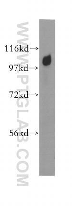 alpha Adaptin Antibody in Western Blot (WB)
