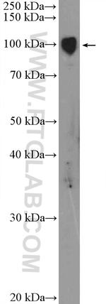 alpha Adaptin Antibody in Western Blot (WB)