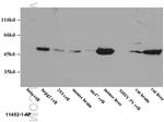 EEF1A1 Antibody in Western Blot (WB)
