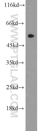 EEF1A1 Antibody in Western Blot (WB)