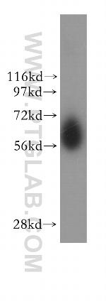 NDOR1/NR1 Antibody in Western Blot (WB)