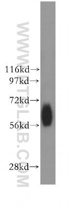 NDOR1/NR1 Antibody in Western Blot (WB)