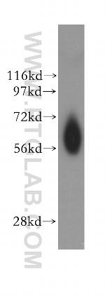 NDOR1/NR1 Antibody in Western Blot (WB)
