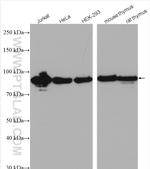 HSP90AB1 Antibody in Western Blot (WB)