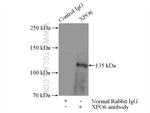 XPO6 Antibody in Immunoprecipitation (IP)