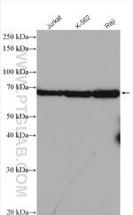 IL2RG Antibody in Western Blot (WB)